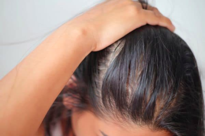 5 cách đơn giản "cấp cứu" cho mái tóc bết dầu khó chịu
